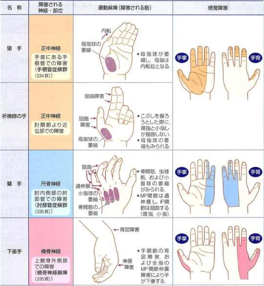 手指 神経麻痺 整体 鍼灸なら実績と信頼の メディカルジャパン新宿